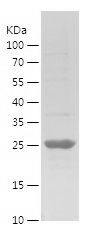 Recombinant Human ERCC1