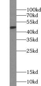 PTGER3 antibody
