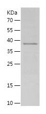 Recombinant Human IL-24