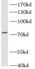 ACSL3 antibody