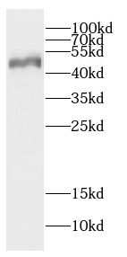 CA14 antibody