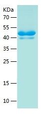 Recombinant Human CLTB