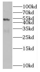 NUF2 antibody