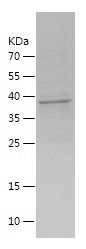 Recombinant Human SFTPC