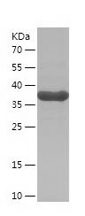 Recombinant Human GMFB