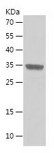 Recombinant Human MBD3