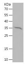 Recombinant Human HOOK3