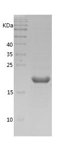Recombinant Human CFL1
