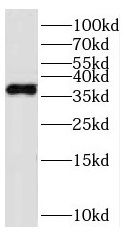 PARVG antibody