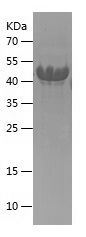 Recombinant Human CDKN1C
