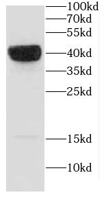CAPG antibody