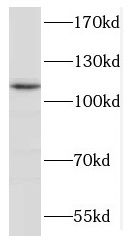 GLDC antibody