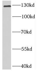 BNC2 antibody