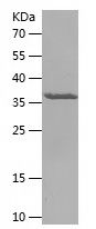 Recombinant Human NDUFA5