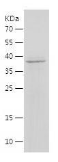 Recombinant Human DHRS3