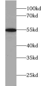 TXNRD1 antibody
