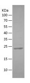 Recombinant Human ARMCX3