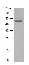 Recombinant Human OFD1