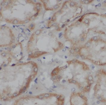 TSLP antibody