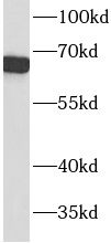 ACTR5 antibody