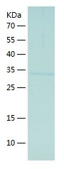 Recombinant Mouse VP1