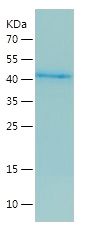 Recombinant Human GGCT