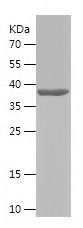 Recombinant Human TBC1D17