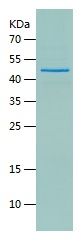 Recombinant Human LIMK1