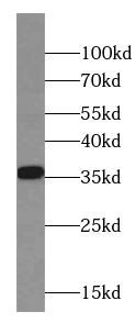 CNN2 antibody