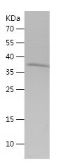 Recombinant Human SLC16A1