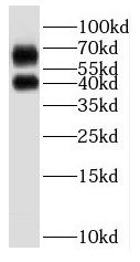 P2RY1 antibody