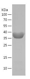 Recombinant Human DDX25