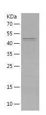 Recombinant Human CIDEA
