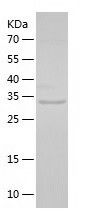 Recombinant Human GRAP2