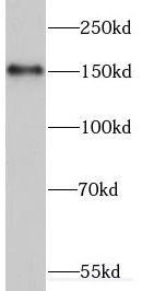 ERCC6 antibody