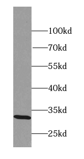 MARCHF8 antibody