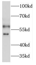 KCNJ2 antibody