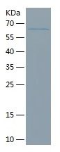 Recombinant Human AD7C