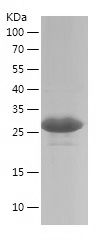 Recombinant Human ETV5