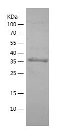 Recombinant Human ARSA