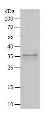 Recombinant Human SFMBT2