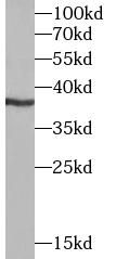 DMC1 antibody