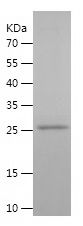 Recombinant Human PGD
