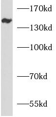 ANKRD50 antibody