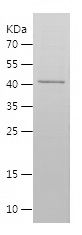 Recombinant Human LONP1