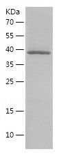 Recombinant Human RPL11