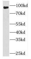 PLA2G4D antibody
