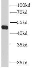 B4GALT4 antibody
