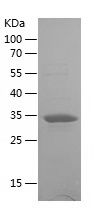 Recombinant Human UPB1