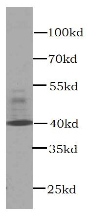 CXCR3-specific antibody